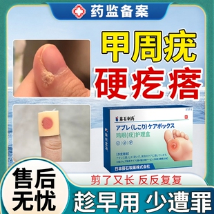 甲周疣寻常疣手上长硬疙瘩硬皮去手指疣根可搭祛疣膏药贴专用贴JW