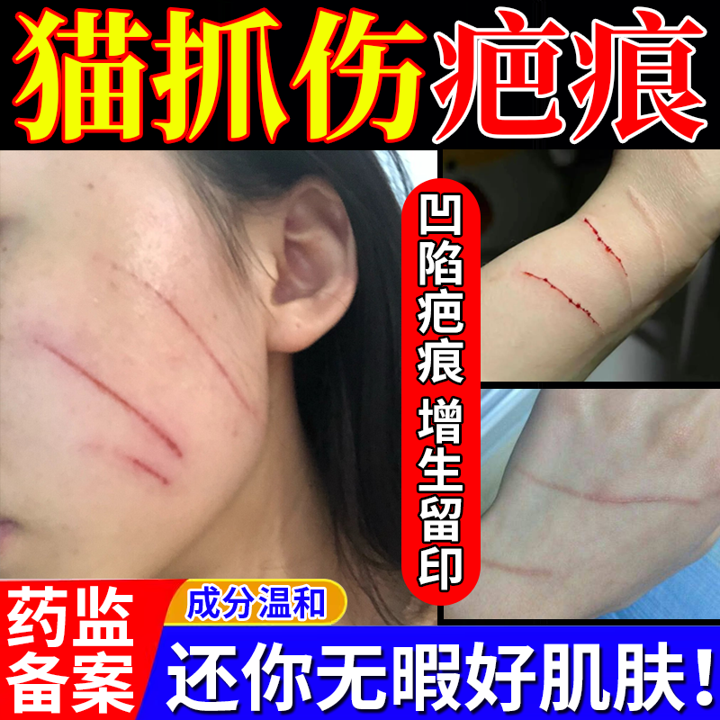 人被猫抓伤祛疤膏宠物挠伤疤痕快速愈合修复去除凹陷疤药房同款BS