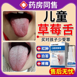 儿童草莓舌调理猩红热舌乳头炎舌立康舌炎喷雾剂杨梅舌舌头溃疡BS