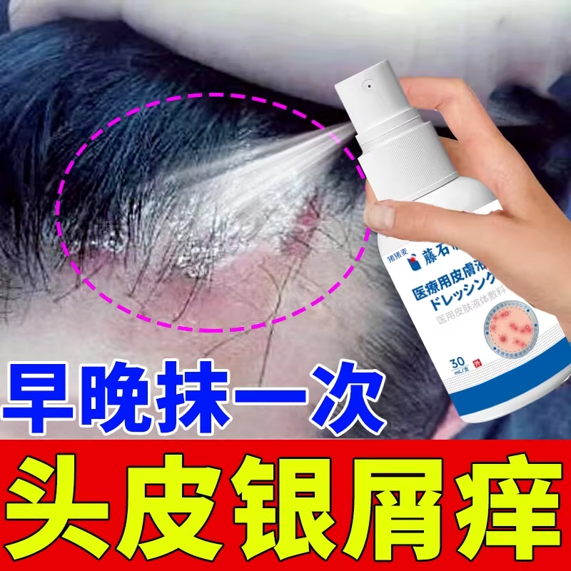 头皮真菌感染牛皮癣洗头膏银屑病专用去银血病和洗发水薬房款膏DZ