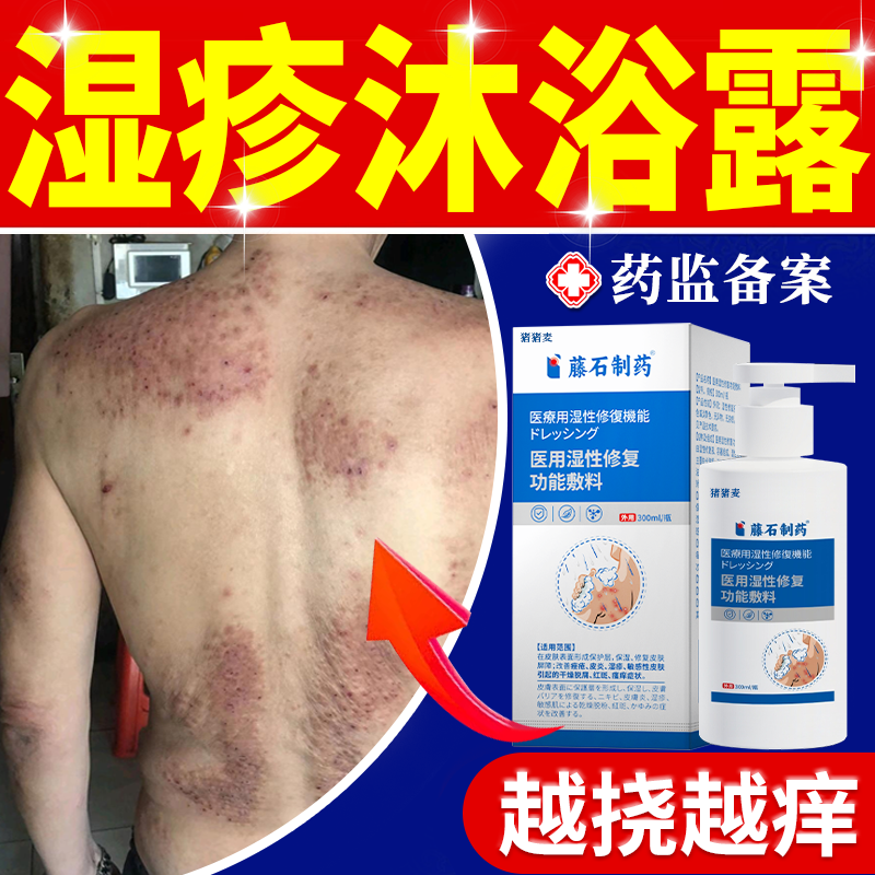 【医用级】湿疹止痒沐浴露