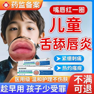儿童舌舔口周唇炎皮炎嘴唇防干裂脱皮专用防止小孩舔嘴唇唇膏药EM