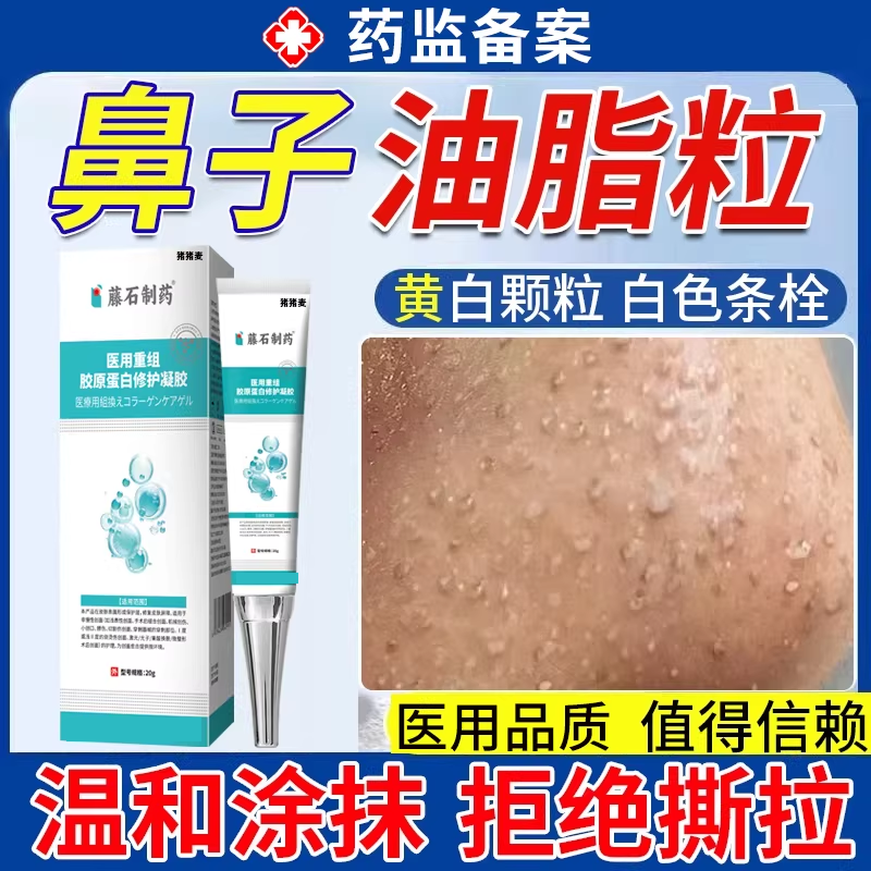 鼻子上脂肪粒去油脂粒鼻头疖肿脂溢性皮炎去白色粒颗粒粉刺闭口MP