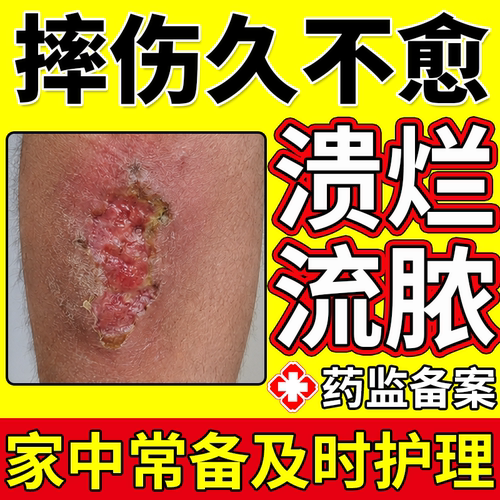 【医用级别】摔伤破皮久不愈合膏