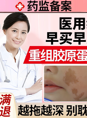 皮肤神经纤维瘤药膏皮肤牛奶咖啡斑胎记去除神器儿童药房同款膏OZ