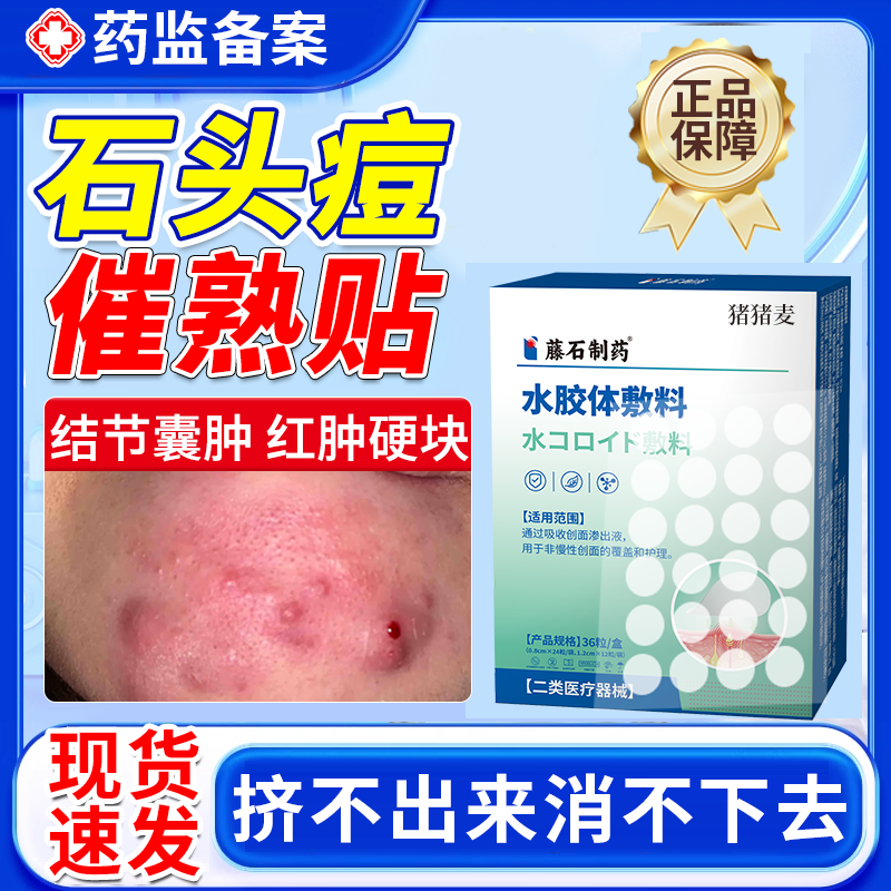 祛石头痘痘贴催熟红肿硬块痘下巴反复长痘医用修复消炎痘印吸脓QF