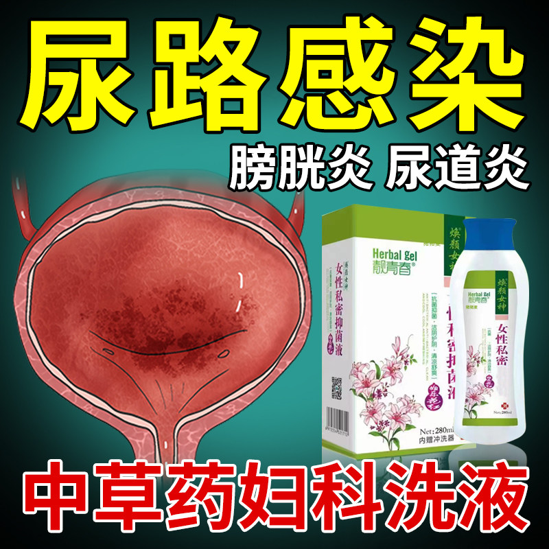 尿道炎尿路感染女性膀胱炎尿频尿急妇科洗液止痒消炎去异味中药DF