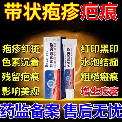 带状疱疹疤痕增生疙瘩一次买对