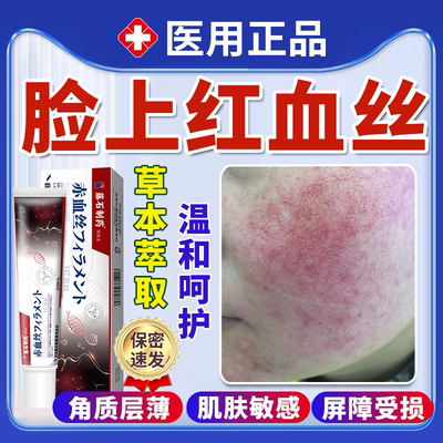 【医用正品】去脸上红血丝专用膏