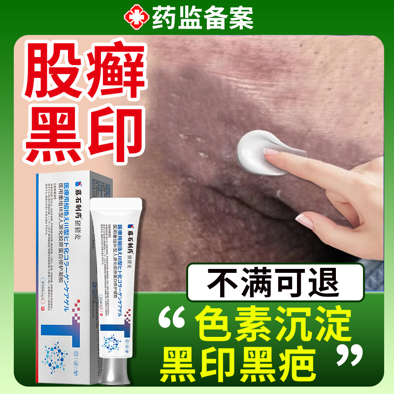 针对股癣黑印【不满意随时退】