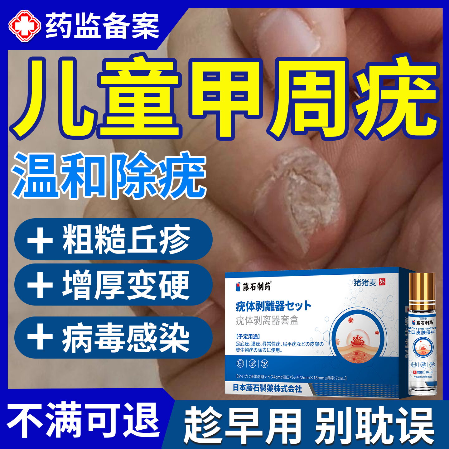 儿童甲周疣硬疙瘩硬皮去除