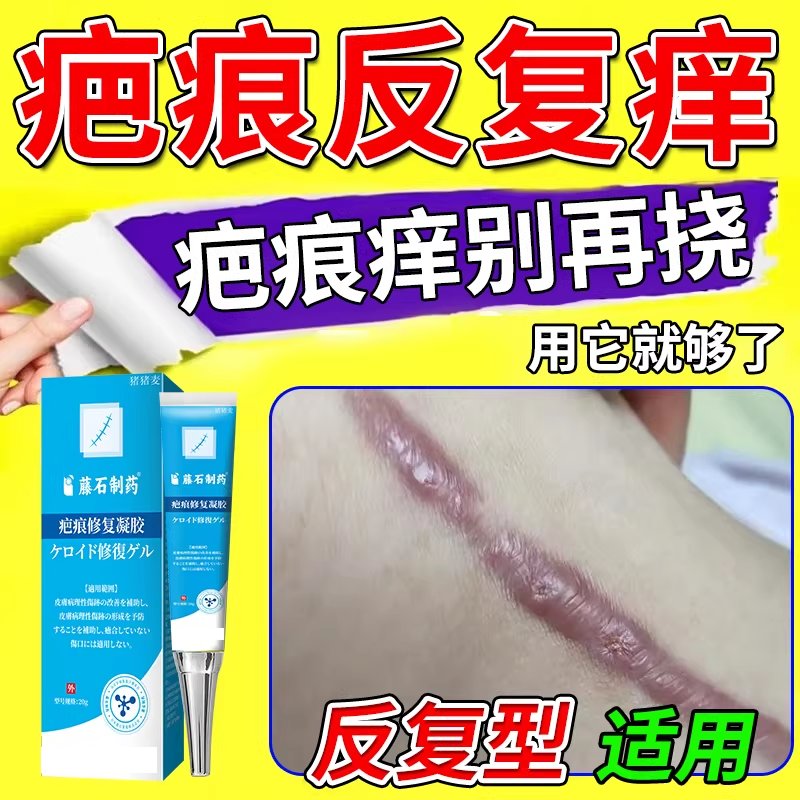 手术后疤痕止痒软化乳膏剖腹产伤口止痒药房款增生凸起去除疙瘩MP