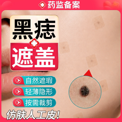 【现货速发】黑痣自然隐形遮盖贴