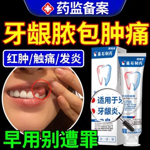 牙龈脓包肿痛消炎专用肿包药房有售牙根发炎长脓包可搭喷剂牙膏OZ