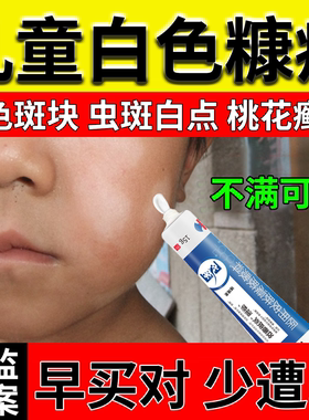 白色糠疹薬房同款祛斑膏儿童脸上长白斑白点专用宝宝小孩子脸部DZ