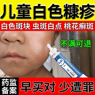 白色糠疹薬房同款祛斑膏儿童脸上长白斑白点专用宝宝小孩子脸部DZ