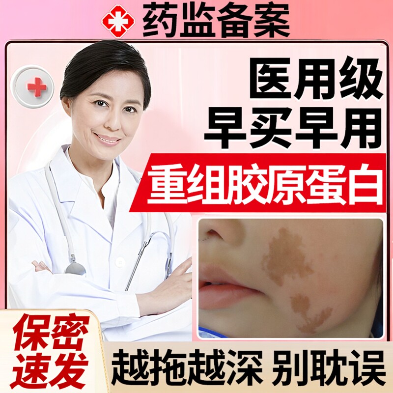 皮肤神经纤维瘤药膏皮肤牛奶咖啡斑胎记去除神器儿童药房同款膏OZ