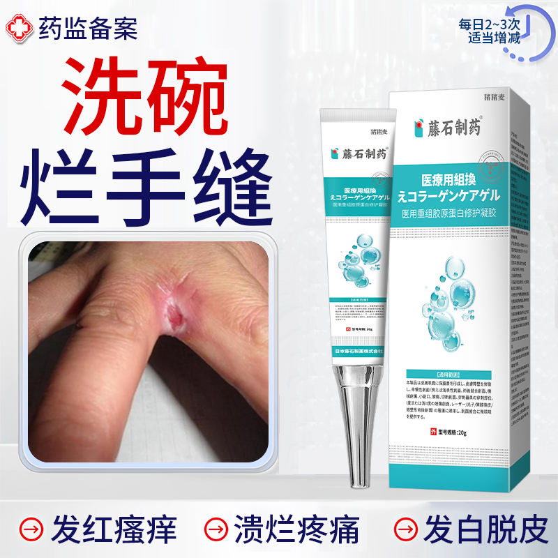 烂手丫专用指缝烂痒脱皮手指缝间溃烂洗碗烂手水泡薬房同款软膏JW