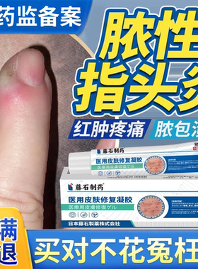 脓性指头炎手指甲内红肿疼溃烂甲沟炎边缘发手指流脓炎消肿化脓EM