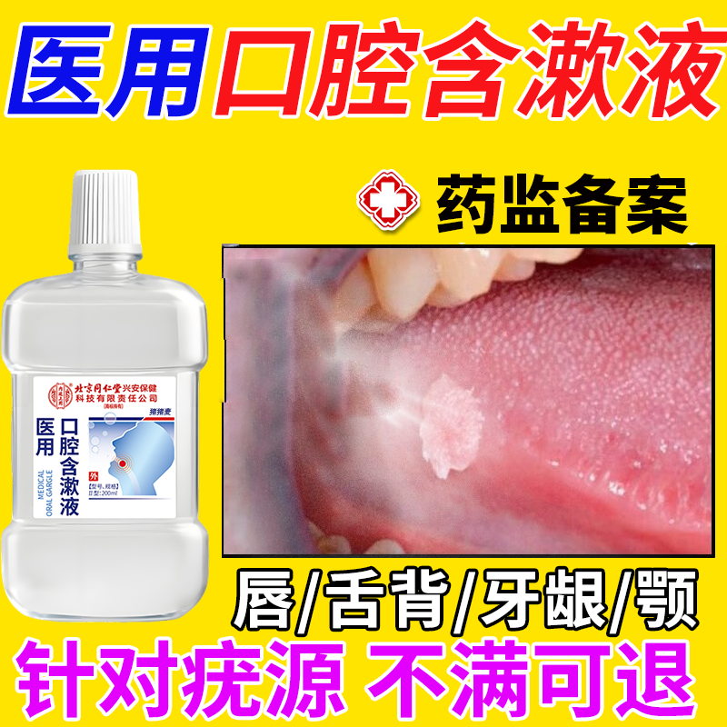 口腔舌头尖锐湿疣长肉芽菜花疙瘩