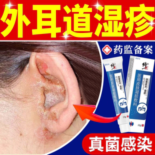 耳朵湿疹外耳道真菌感染去外用顽固皮炎根脂溢性专用除湿止痒膏JW