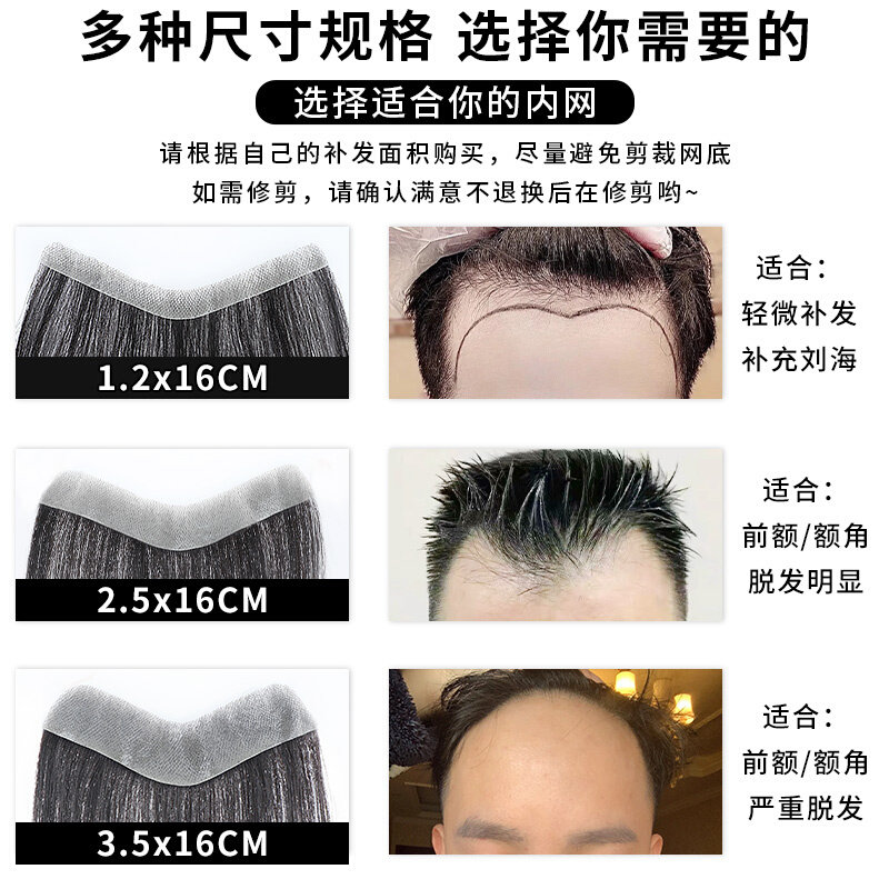 正品发际线假发贴男士前额发际线假刘海贴真发隐形无痕逼真高额头