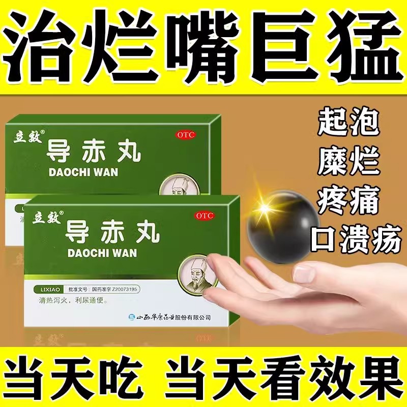 导赤丸北京嘴巴上火起泡烂口腔溃疡专用药非导赤散导赤片尿路感染