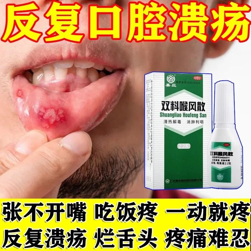 嘉应牌双料喉风散2.2g旗舰店正品清热解毒消肿利咽齿龈咽喉肿痛JY图片