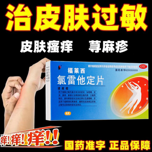 氯雷他定片24片荨麻疹皮肤过敏止痒药根断儿童口服药非日本药