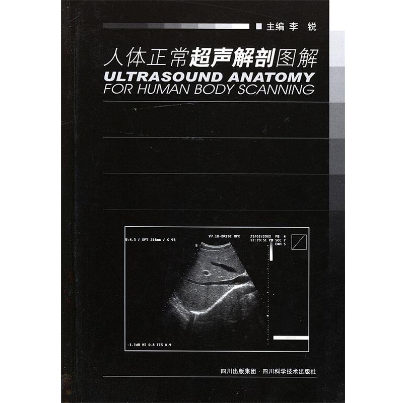 【正版书】 人体正常超声解剖图解 李锐 主编 四川科技出版社