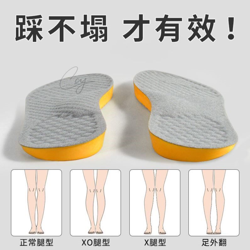 日本xo型腿足外翻矫正鞋垫纠正小腿外翻内八字脚改善腿型成人脚垫