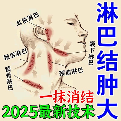 淋巴结肿大散结贴膏特效药消除脖子颈部腋下耳后消散结节硬块神器