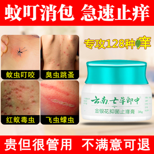 被臭虫跳蚤毒虫咬伤止痒膏蚊虫叮咬婴儿成人皮肤瘙痒手脚消红痒药