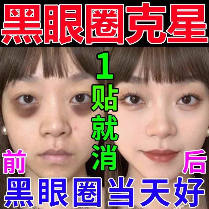 黑眼圈去除神器特别严重祛眼袋黑色素沉淀消泪沟学生男士专用克星