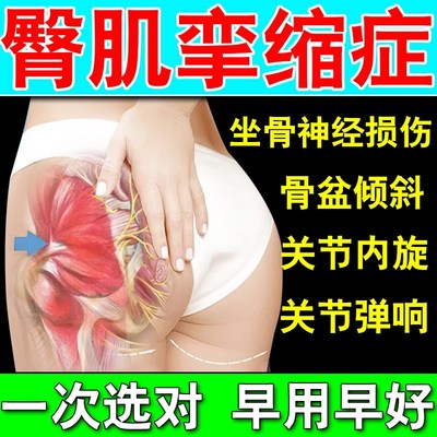 臀肌挛缩症贴膏治疗死臀综合征屁股梨状肌疼痛盆骨倾斜关节内旋贴