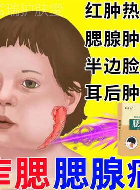 腮腺炎贴腮帮子肿大疼耳后硬结痄腮贴腮腺囊肿腮腺混合瘤吞咽困难