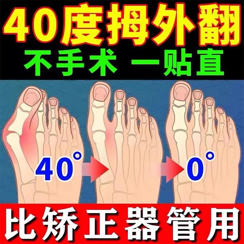 拇指外翻贴大脚骨矫正神器脚趾重叠防磨脚趾变形疼痛贴