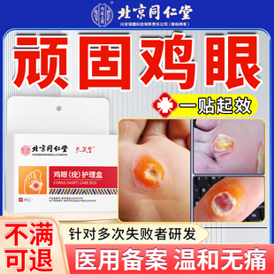 北京同仁堂脚鸡眼膏贴手根医用型官方除旗舰店肉刺跖疣瘊子药膏去