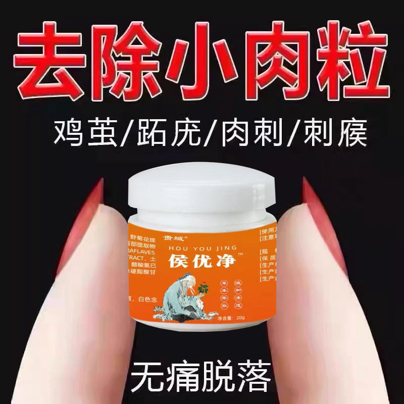 正品【轻轻一抹】身上肉粒脖子脸部头部腋下手脚尤温和草本外用霜