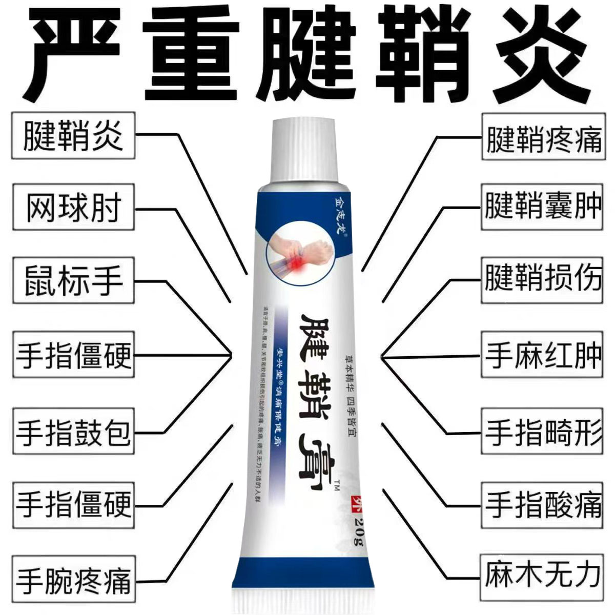 腱鞘炎手指手腕关节痛劳损扭伤筋骨疼痛消肿凝胶僵直麻木弹响鼓包