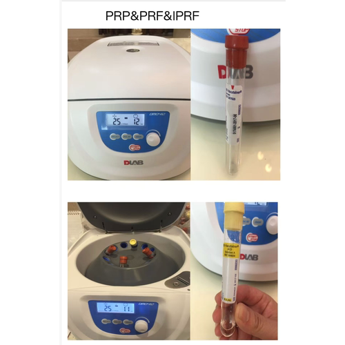 PRP PRF IPRF 制备离心机离心管10毫升黄管10ml红管液体凝胶管
