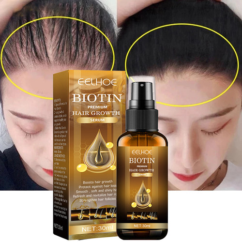 Ginger Hair Fast Growth Serum Spray Biotin Anti Hair Loss