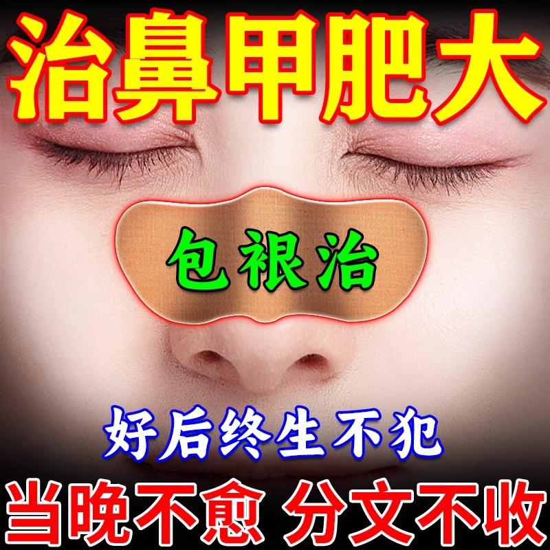 鼻甲肥大专用特效药消炎修复儿童鼻炎鼻窦炎鼻中隔偏曲通鼻塞神器