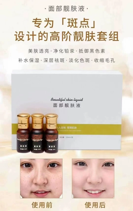 祛斑液治疗液调理液排毒液脸部靓肤液排解皮肤深层黑色素细滑通透