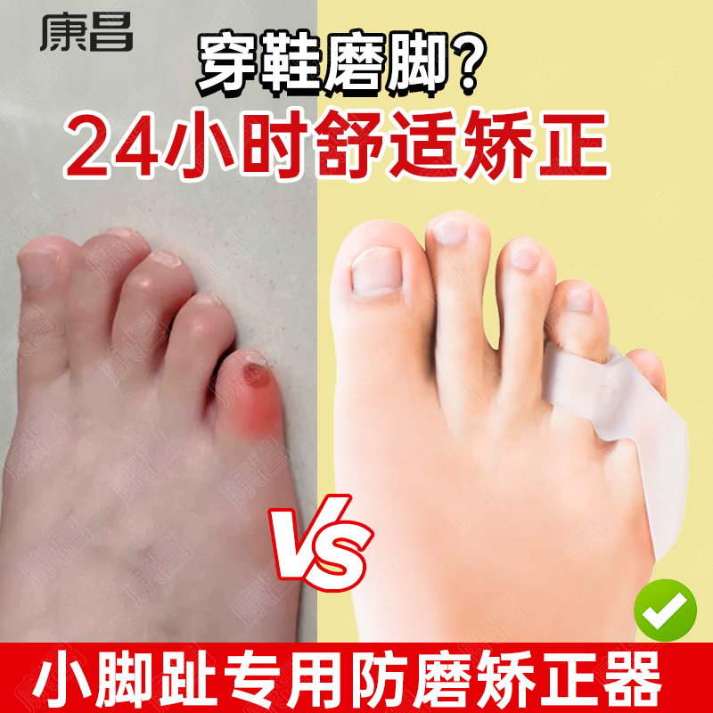 小脚趾分趾器男女无痛分趾