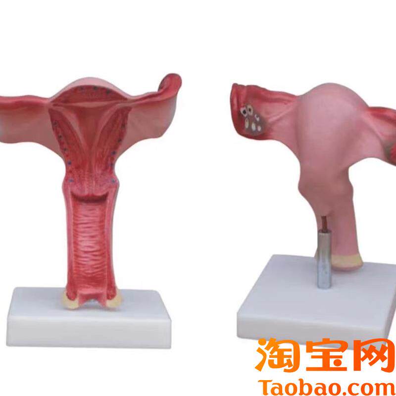子宫放大模型阴道生殖器官卵巢输卵管剖面Q教学训练解剖模具