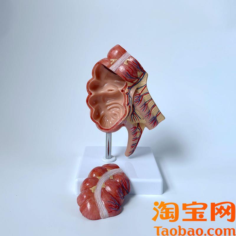 盲肠模型阑尾肠壁l粘膜回盲瓣肛肠科室摆件消化道医药促销医用教