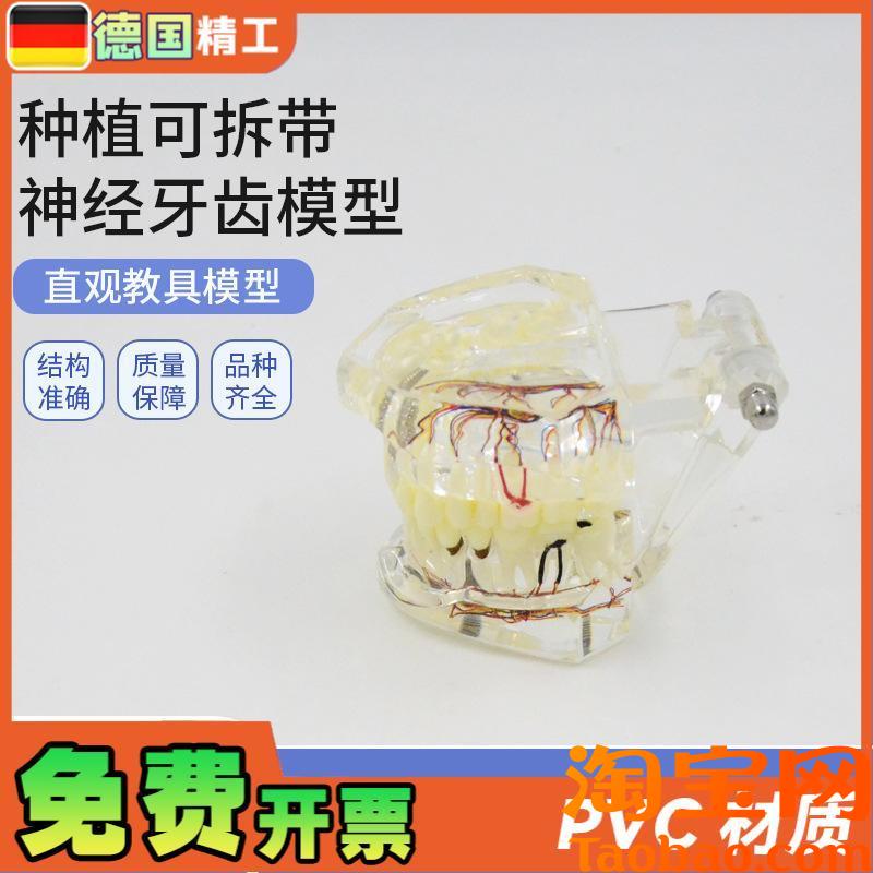 原装适用德国】PNT-OR16口腔牙科种植可拆带神经牙齿模型可拆卸口