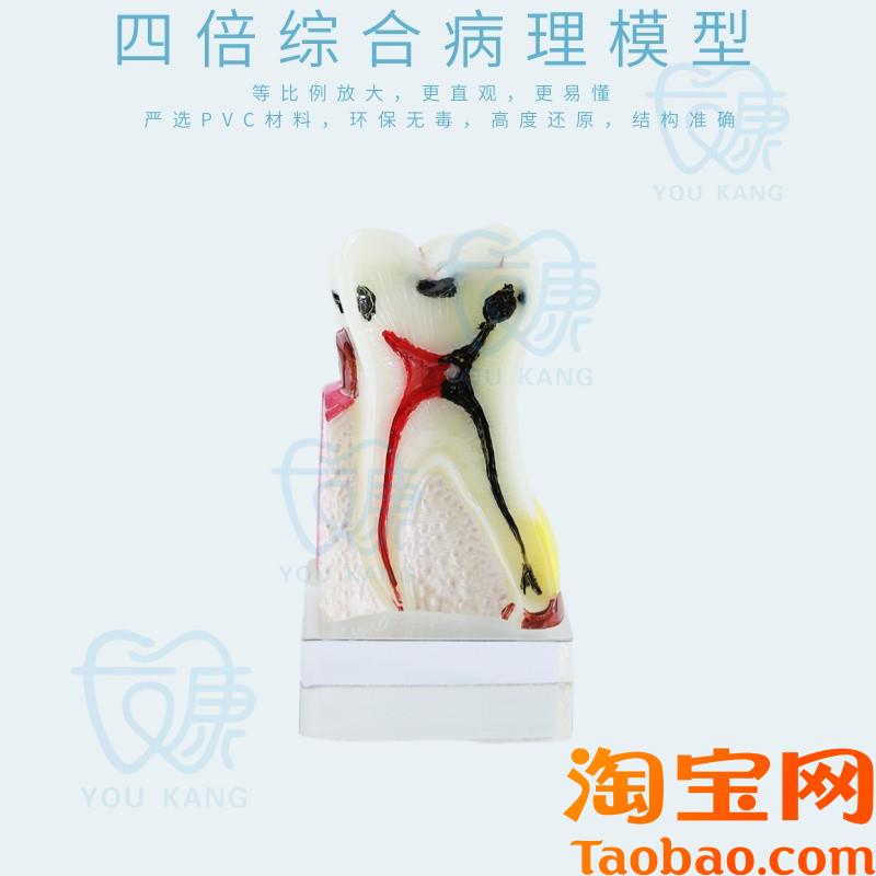 原装适用4倍综合病理模型牙科教学模型牙齿模型口腔练习演示模型