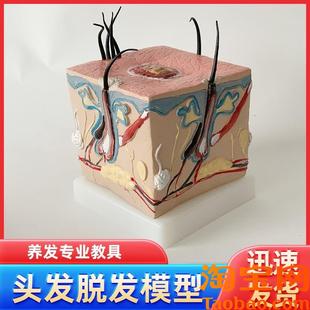 人体毛发脱发模型头发p头皮发炎毛细血管毛囊收缩教学教具演示模